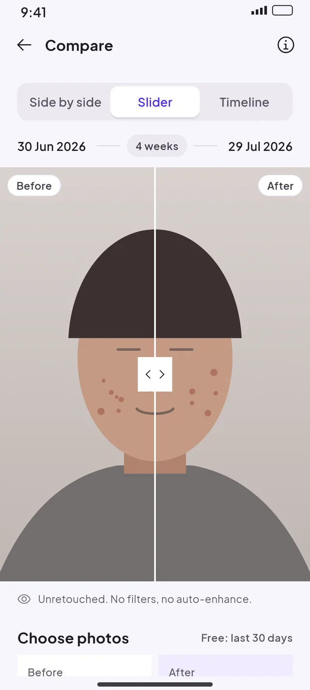 Compare screen with a before and after slider